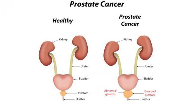 How To Milk My Prostate